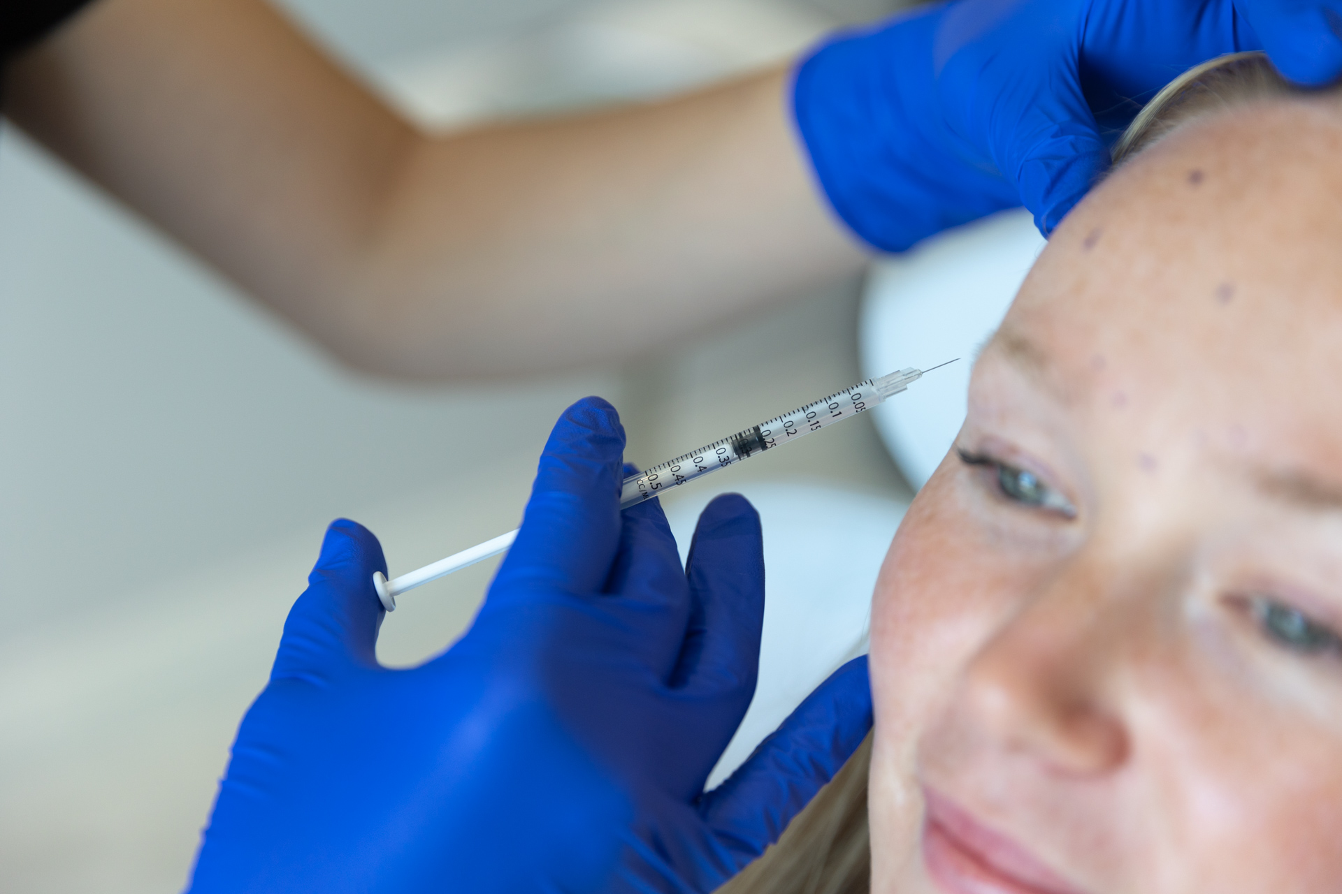 A close-up of a patient receiving Botox on her forehead.