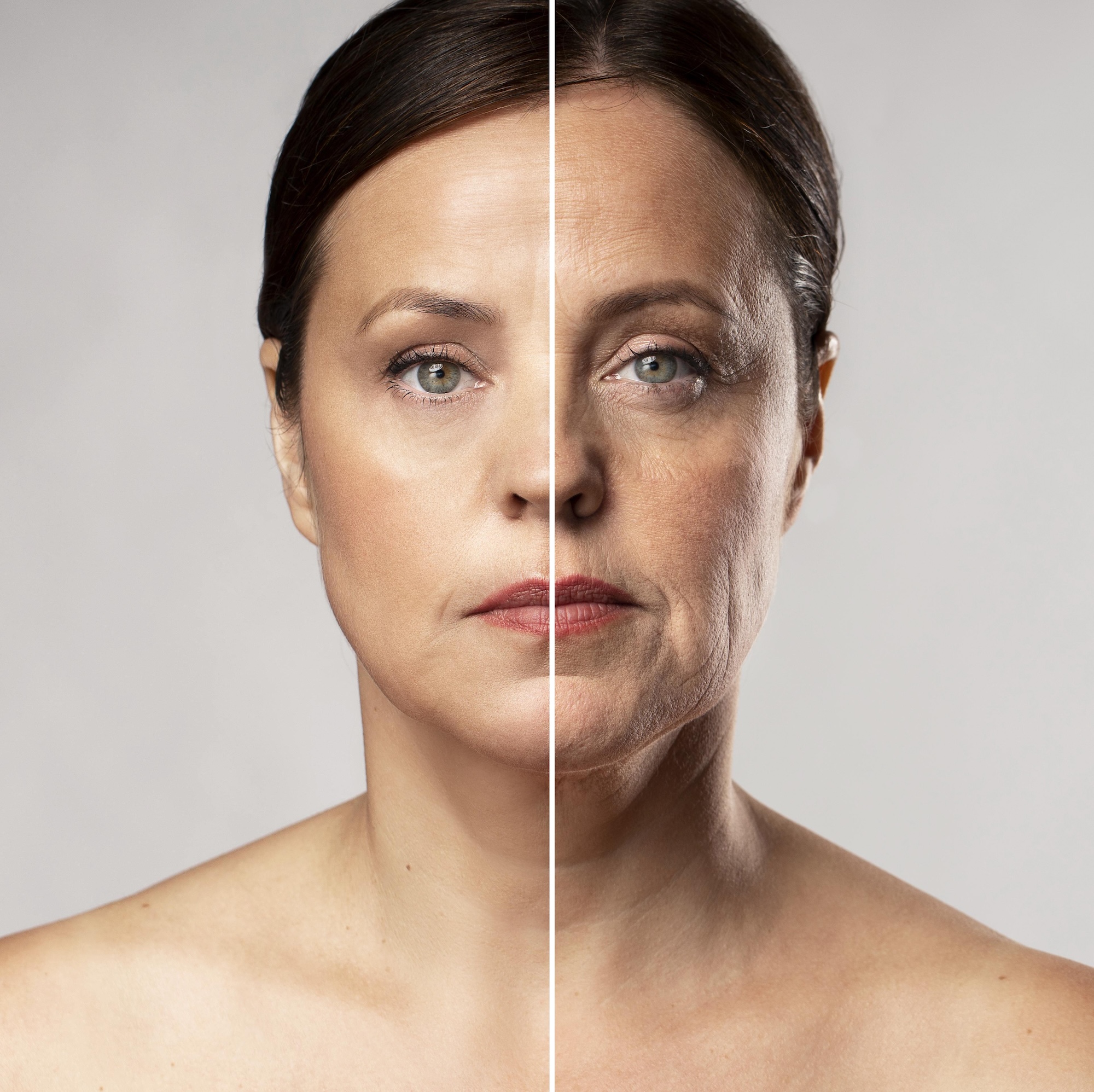 A patient’s before and after picture showing their progress after having Laser Skin Resurfacing in Venice, FL