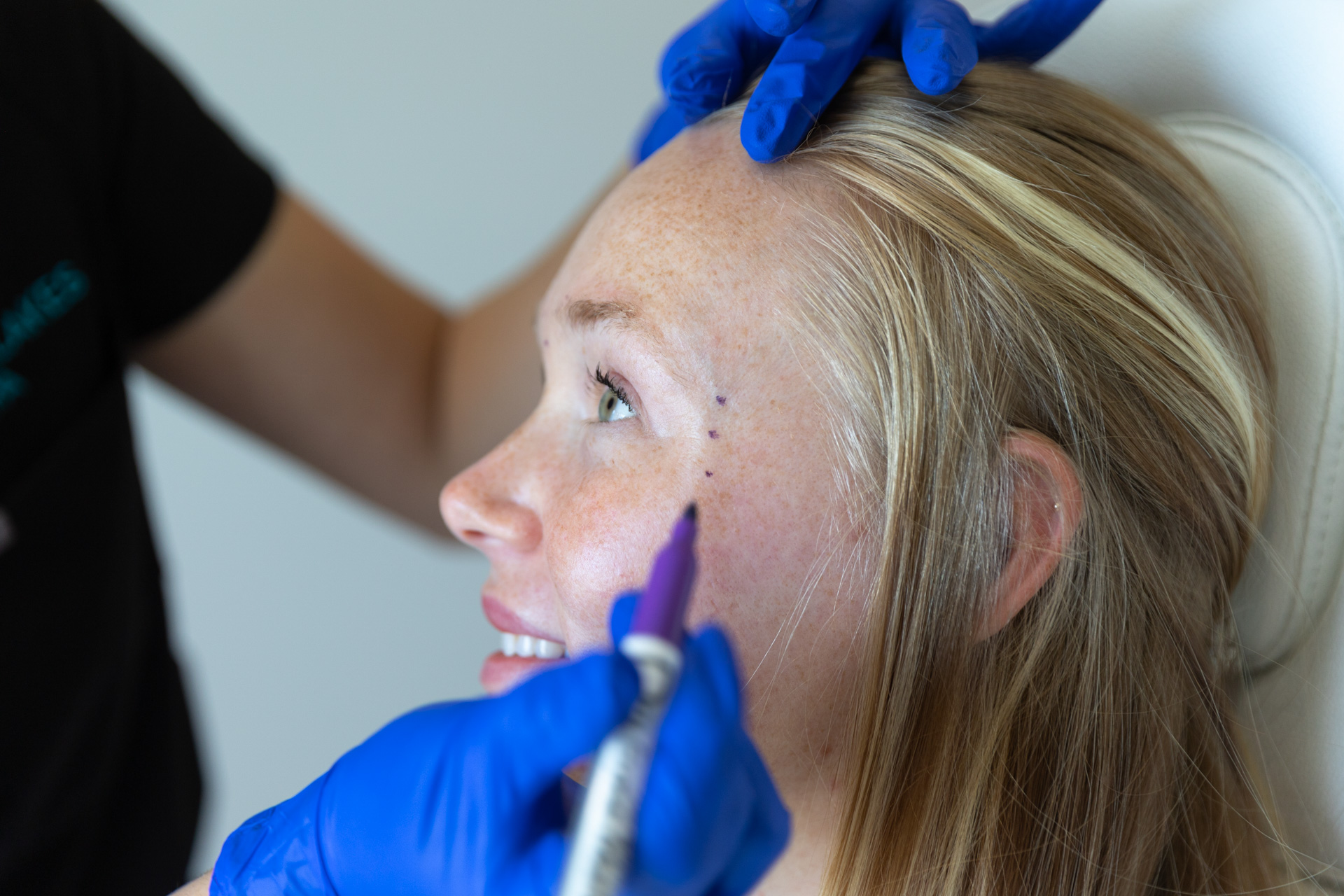 A close-up of an aesthetician marking a patient's face before using Botox near Myakka City.